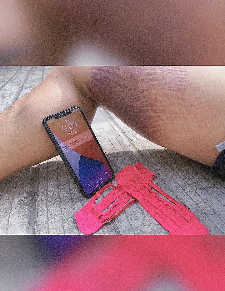 爱游戏官方登录入口-比赛前瞻：球队肌肉拉伤情况不稳，备战策略或须再调整的简单介绍